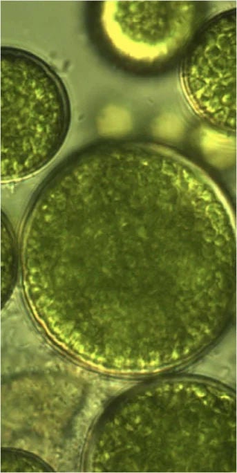 bacterias verdes en microscopio